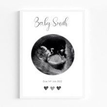 Load image into Gallery viewer, Personalised Ultrasound Scan Print