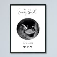 Load image into Gallery viewer, Personalised Ultrasound Scan Print
