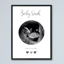 Load image into Gallery viewer, Personalised Ultrasound Scan Print